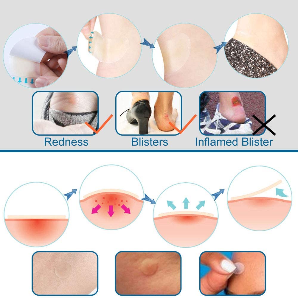Assortiment de pansements hydrocolloïdes adhésifs étanches pour pied
